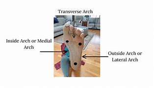 Image result for 3 Arches of the Foot