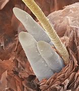 Image result for Eyelash Worms