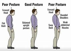 Image result for 5 Proper Standing Posture