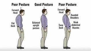 Image result for Slanted Standing Posture