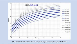 Image result for DiGeorge Growth Chart