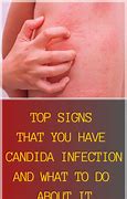 Image result for Candida Die Off Rash