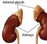 Image result for Where Are Adrenal Glands