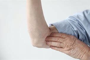 Image result for Upper Arm Pain