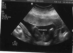 Image result for Male Baby Ultrasound