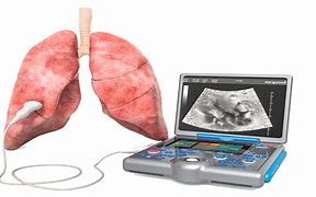 Image result for Pulmonary Regurg Ultrasound Flame