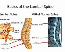 Image result for Lumbar and Sacral Spine