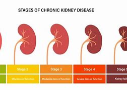 Image result for Chronic Kidney Disease