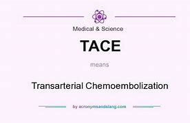 Image result for Tace