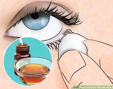 Image result for Face Mites Treatment