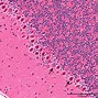 Image result for Brain Tissue Histology