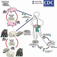 Image result for Trichinosis Parasite