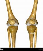 Image result for Knee Bones and Joints