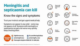 Image result for Meningitis Signs