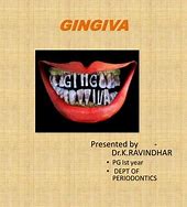 Image result for Col Gingiva