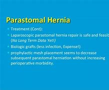 Image result for Colostomy Hernia