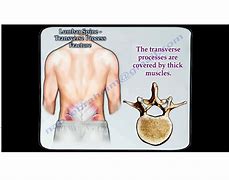 Image result for Transverse Spine