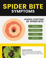 Image result for Early Spider Bite