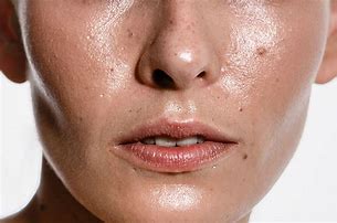 Image result for Hard Sebum in Pores