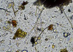 Image result for Fungal Hyphae in Soil