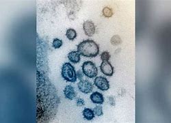 Image result for Virus Paling Mematikan Di Dunia