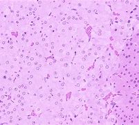 Image result for Adrenal Medulla