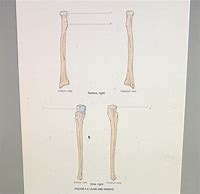 Image result for Posterior View of the Radius