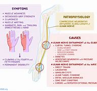 Image result for Pin Nerve Function