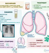 Image result for Pathophysiology of Empyema