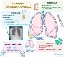 Image result for Empyema Thoracis X-ray