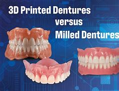 Image result for Printed Dentures