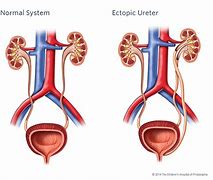 Image result for Foto Ureter