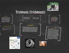 Image result for Trichiniasis