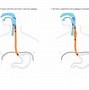 Image result for Relations of Esophagus