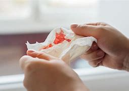 Image result for patient coughing blood