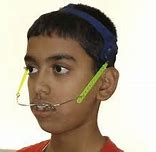 Image result for Full Orthodontic Headgear