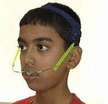 Image result for Orthodontic Headgear