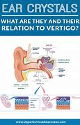 Image result for Inner Ear Infection Vertigo