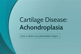 Image result for Achondroplasia Height Chart