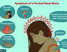 Image result for Pin Nerve Function