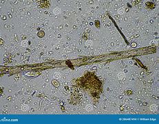 Image result for Fungal Hyphae in Soil