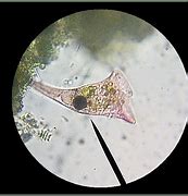 Image result for Stentor Protozoa