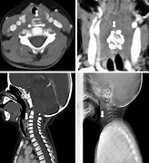 Image result for CTA Scan of Neck