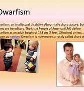 Image result for Pseudo Dwarfism