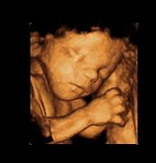 Image result for CT Baby Scan 3D