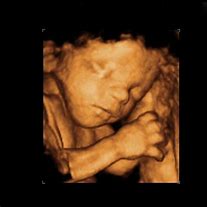 Image result for Mother 4D Baby Scan