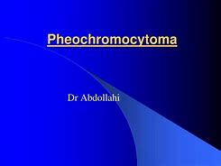 Image result for Pheochromocytoma Presentation