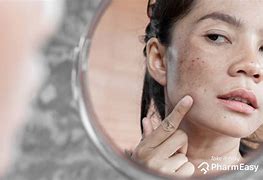 Image result for Face Dark Spots Actress