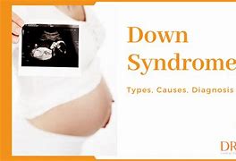 Image result for Ultimate Down Syndrome