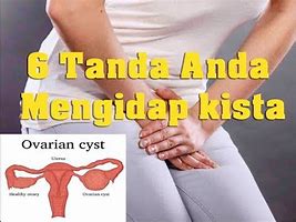 Image result for Kista Adalah